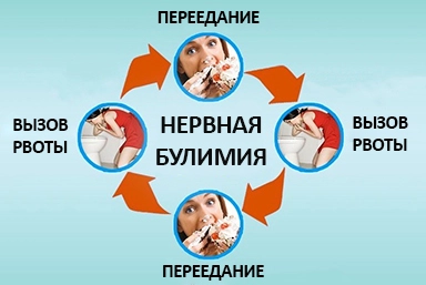 Лечение булимии в Пугачеве